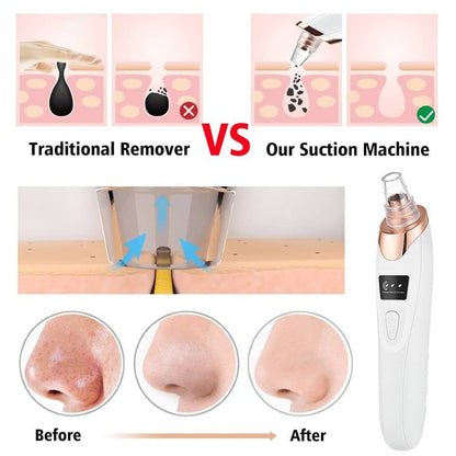 5 in 1 Blackhead remover | Derma Suction | Rechargeable | Free Gift Card 🎁 - Nuvenza